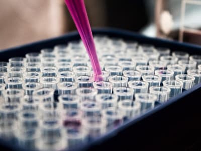 Chemical industry activated carbon purification